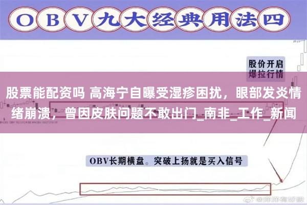 股票能配资吗 高海宁自曝受湿疹困扰，眼部发炎情绪崩溃，曾因皮